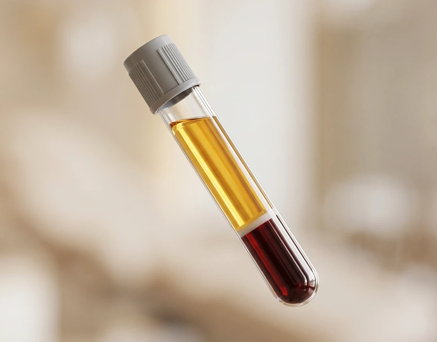 What to Expect with PRP at Renewd Med Spa
